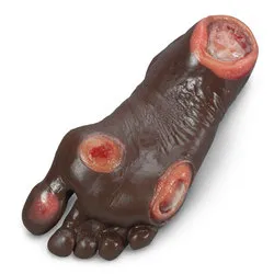 Life/formÂ® Elderly Pressure Ulcer Foot Black