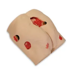 Decubitus Wound Care